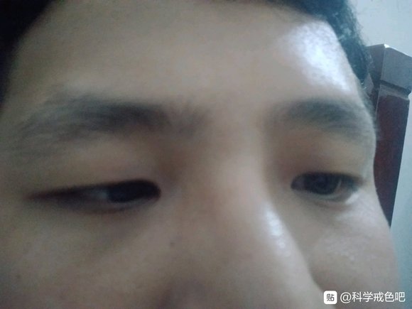 ”我现在手淫导致我的短小，然后的话夜里都是夜尿多同时早泄，腰酸