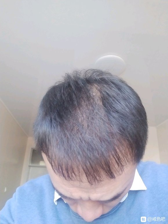 ”该怎么养发呢