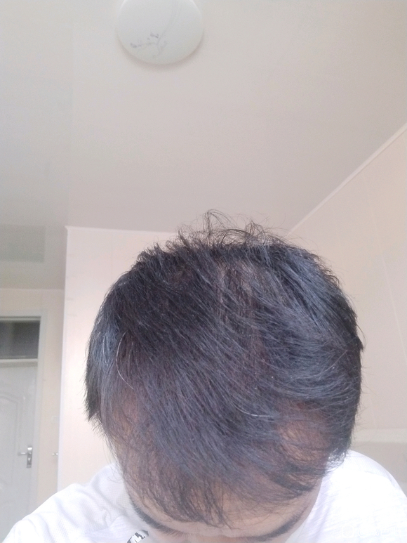 ”该怎么养发呢