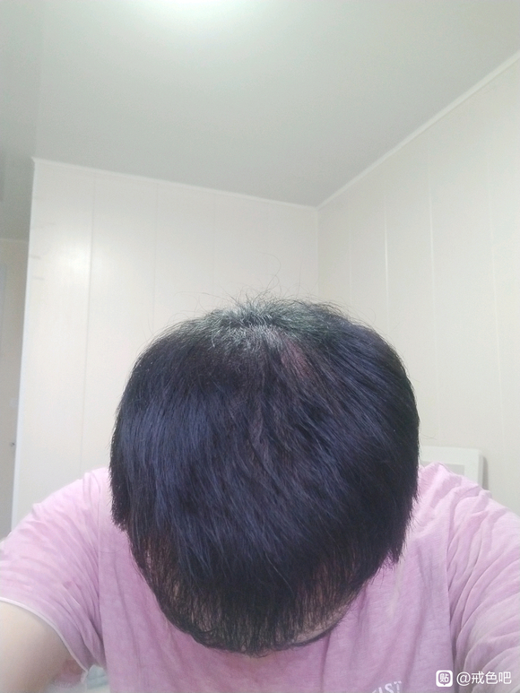 ”该怎么养发呢