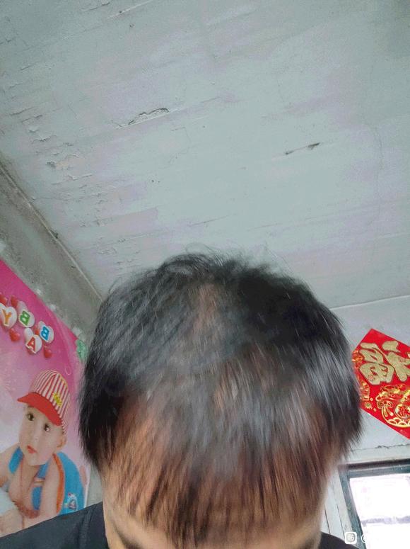 ”该怎么养发呢