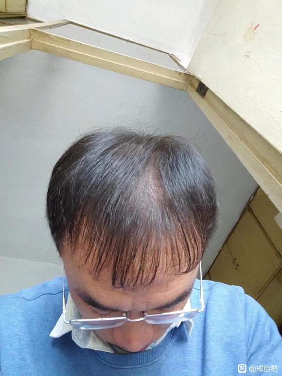 ”该怎么养发呢