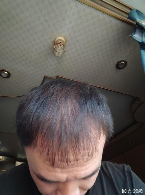 ”该怎么养发呢