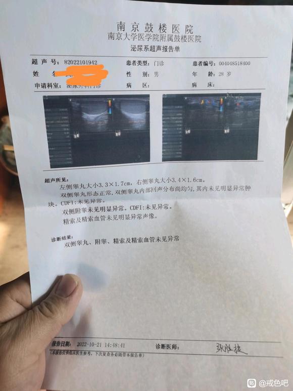 ”有吧友知道精索静脉曲张为什么一会正常一会不正常