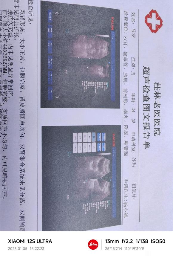 ”有吧友做阴茎埋线手术的吗，说是羊肠线，会被吸收，这个有没有？