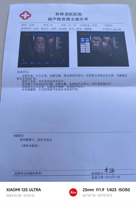 ”有吧友做阴茎埋线手术的吗，说是羊肠线，会被吸收，这个有没有？