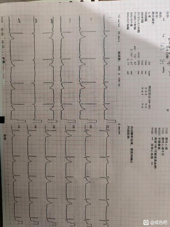 ”看看我一个经常手的人心电图