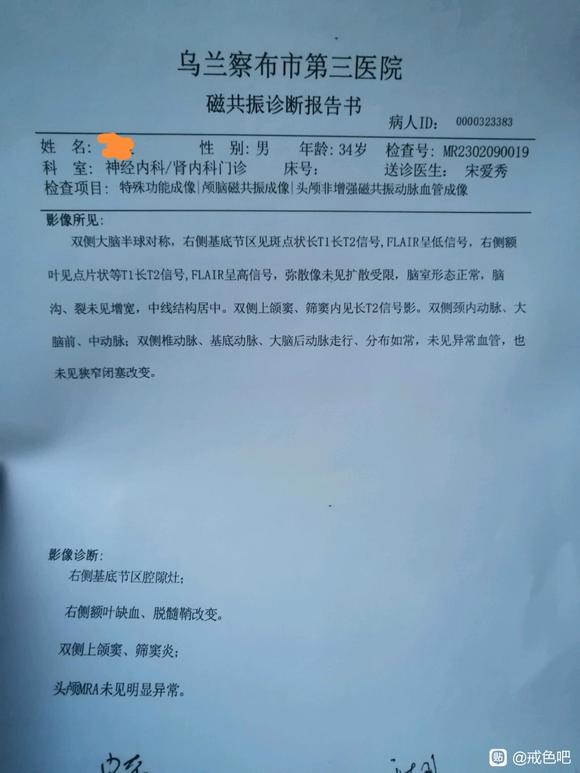 ”谁得了脑腔隙灶，缺血性脱髓鞘改变？？