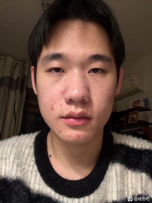 ”【成长记录】今天开始戒手淫，特此开帖记录自己的变化