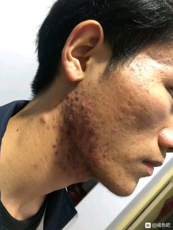 ”戒色前后对比图，精选28张好兄弟们一起努力了