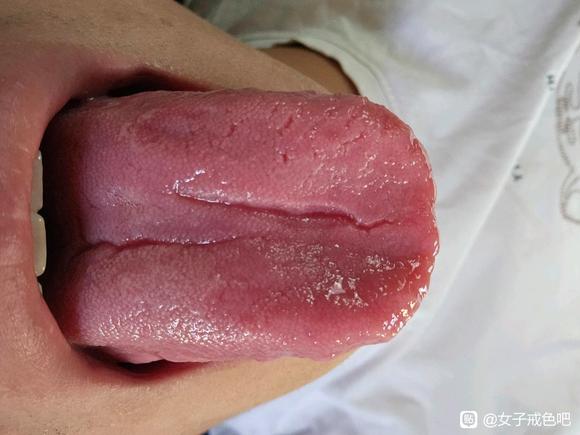 ”戒了10天，舌头开始有血色，不是之前泛白