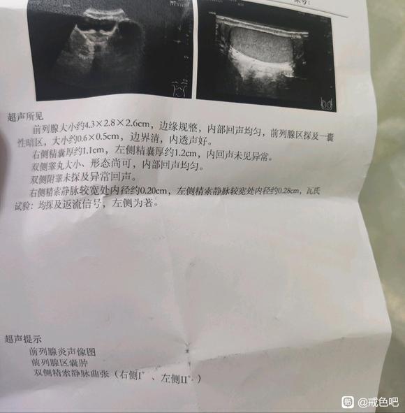 ”这样戒色会好转吗