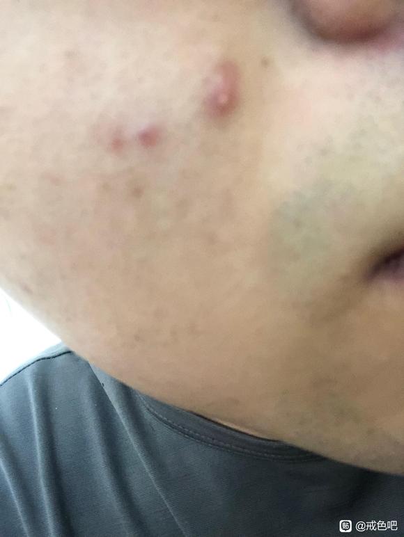 ”这是现在的的脸