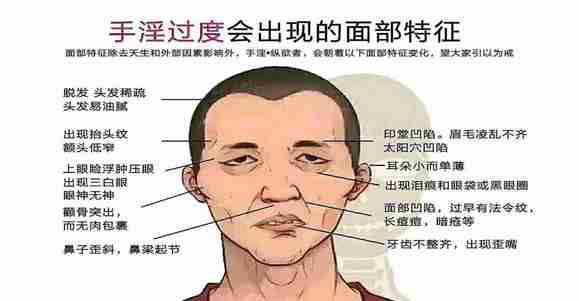 ”龟头敏感，有10年了，以前不懂事，现在后悔了