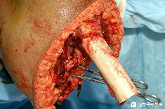 ”不净观——打破邪淫的两种利器之一（转）