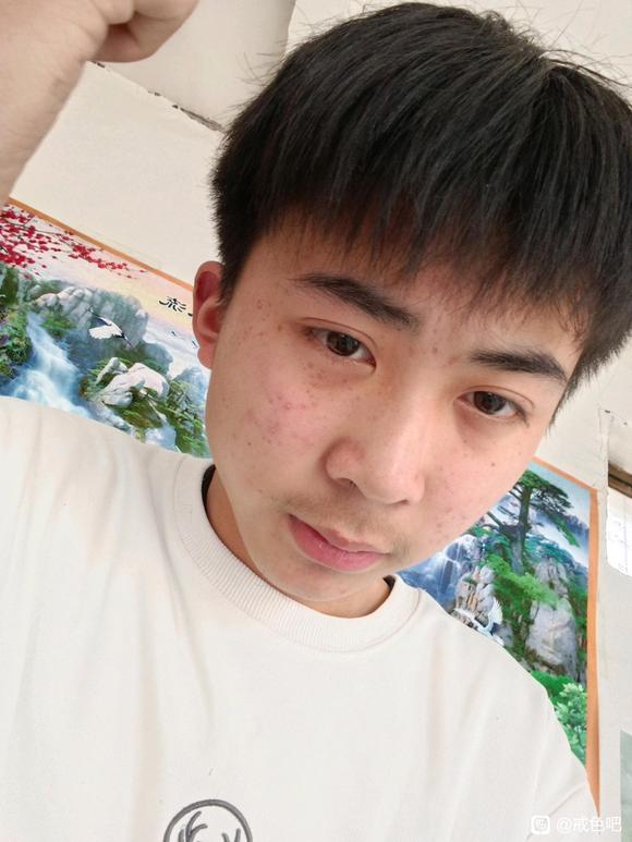 ”加油吧兄弟们，皮肤确实在变好