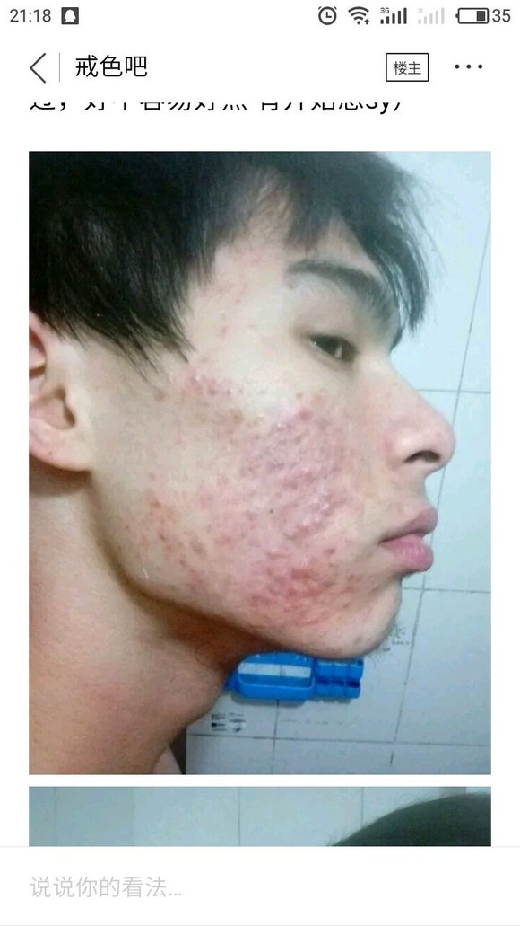 ”这几年来，我搜集了成千上万受到sy危害的案例，发给大家看看！