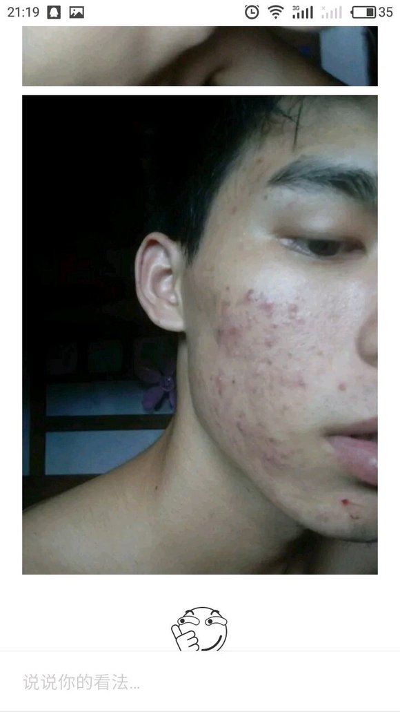 ”这几年来，我搜集了成千上万受到sy危害的案例，发给大家看看！