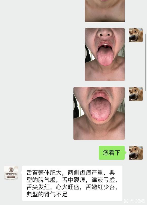 ”问问师兄们这些症状通过戒色?养生能治好嘛