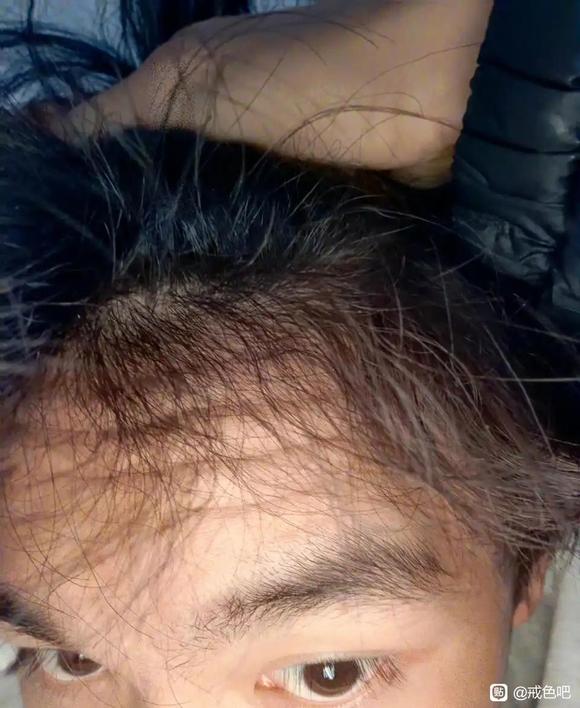 ”#微信看病卖药是假的#以前头发不卷