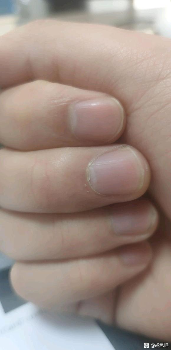 ”手淫会导致神经病