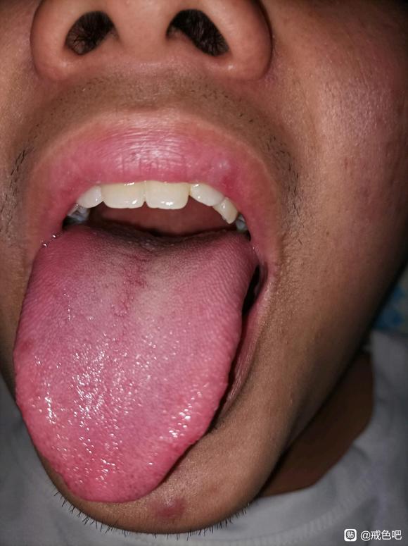 ”中医齐大夫论手淫之危害