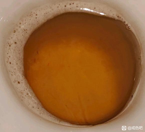 ”这泡沫尿正常吗？