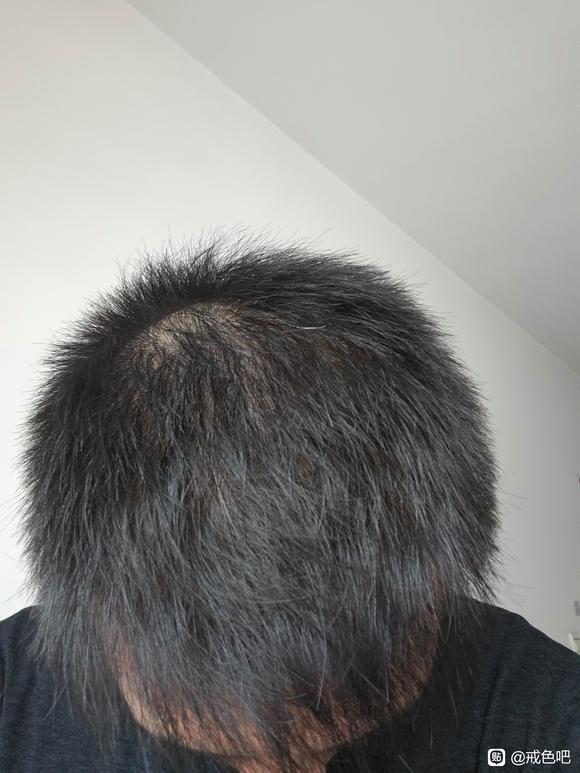 ”开始js，互相监督