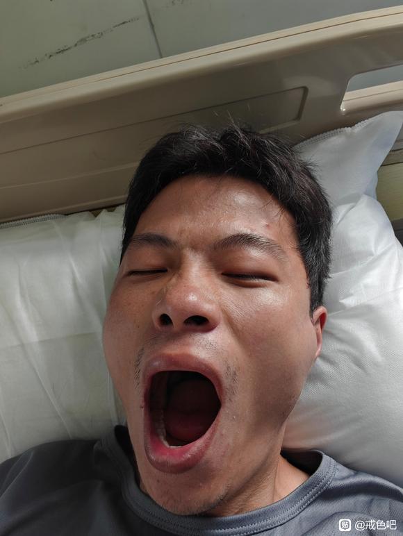 ”【成长记录】戒色第六十八天，吃了药，又吊瓶，身体好多了