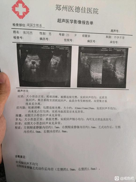 ”精子活力非常查