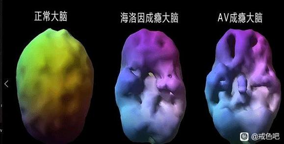 ”如果戒了，大脑会恢复吗？