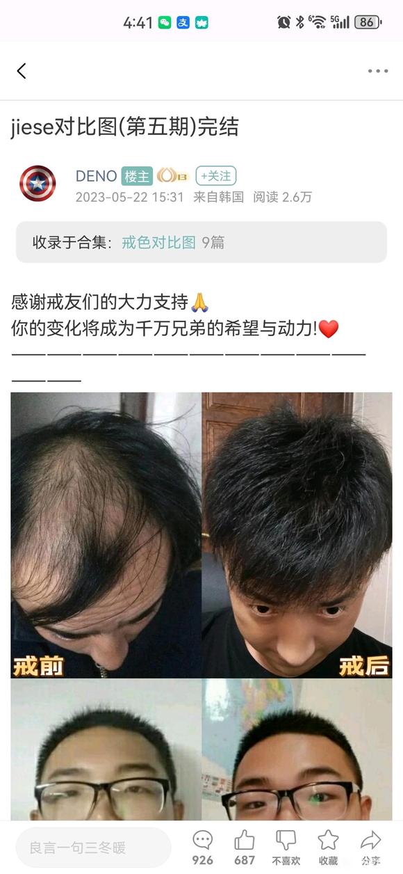 ”有发量恢复的真实案例吗