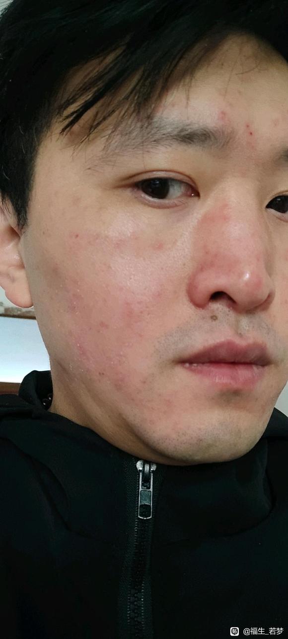 ”戒色第六天，之前破戒后为什么不拿镜子去户外