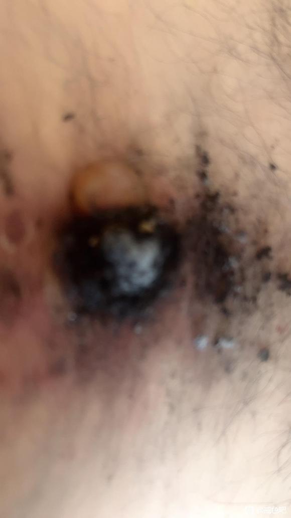 ”如果你伤的比较深虽然戒了，但是难以恢复，不如试试艾灸关元