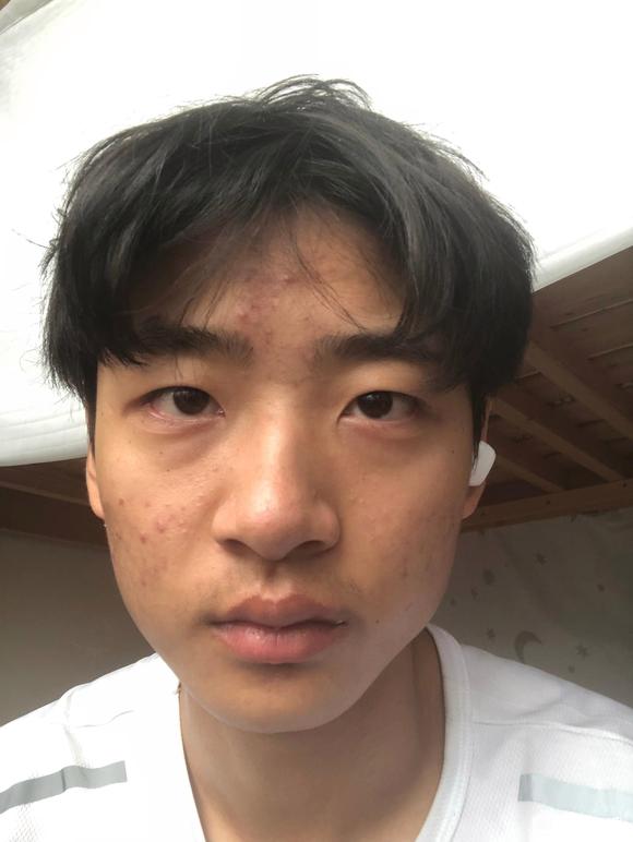 ”#微信看病卖药是假的#师兄们这两个哪个看起来更严重