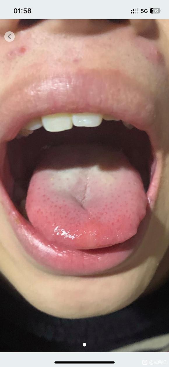 ”各位师兄能帮我看看药方吗，效果怎么样