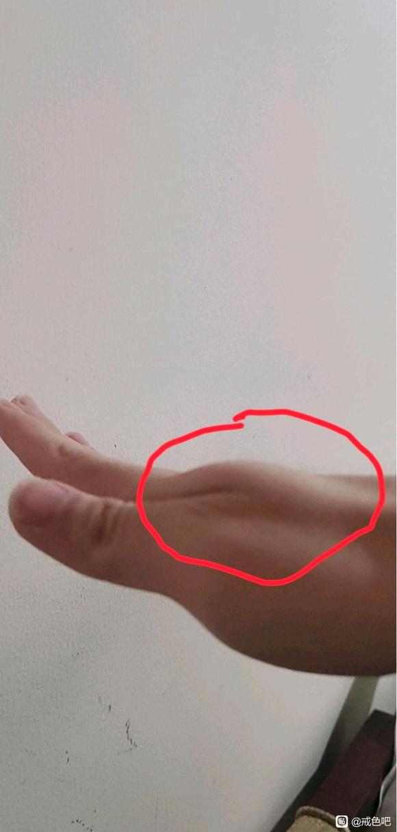 ”拇指这个部位不饱满是什么原因？