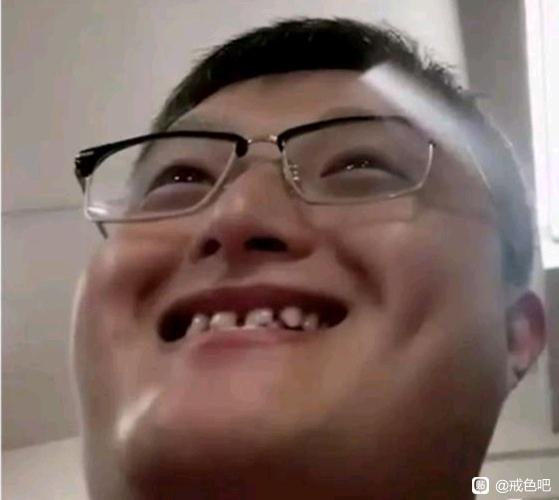 ”Xy十几年的脸，牙齿很烂，长的猥琐，还有救吗