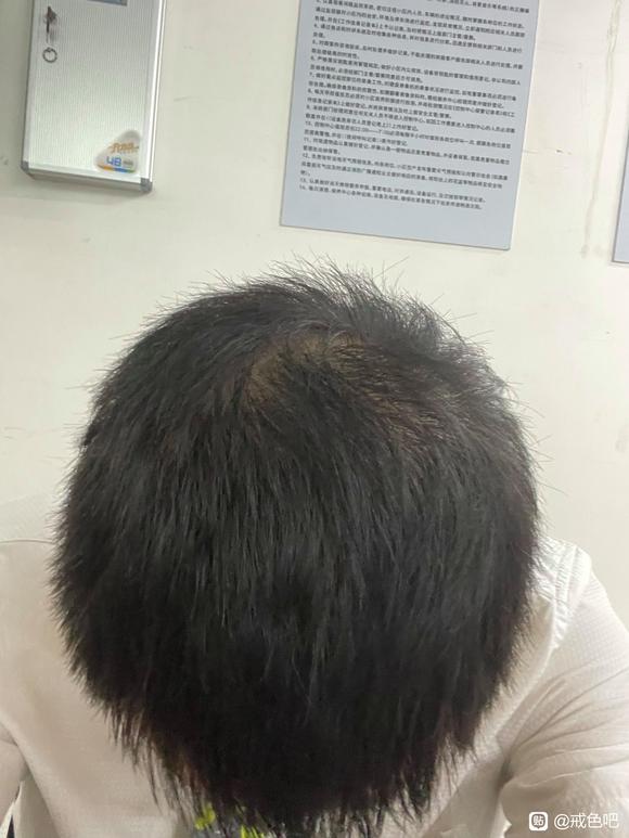 ”我这个算在恢复吗？