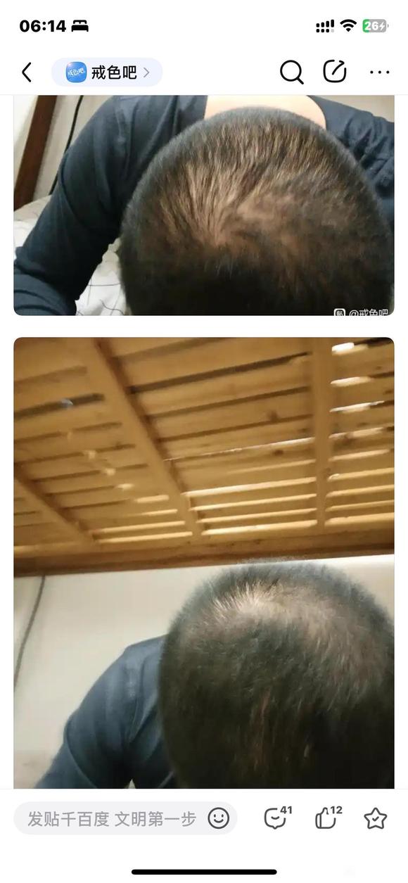 ”我这个算在恢复吗？