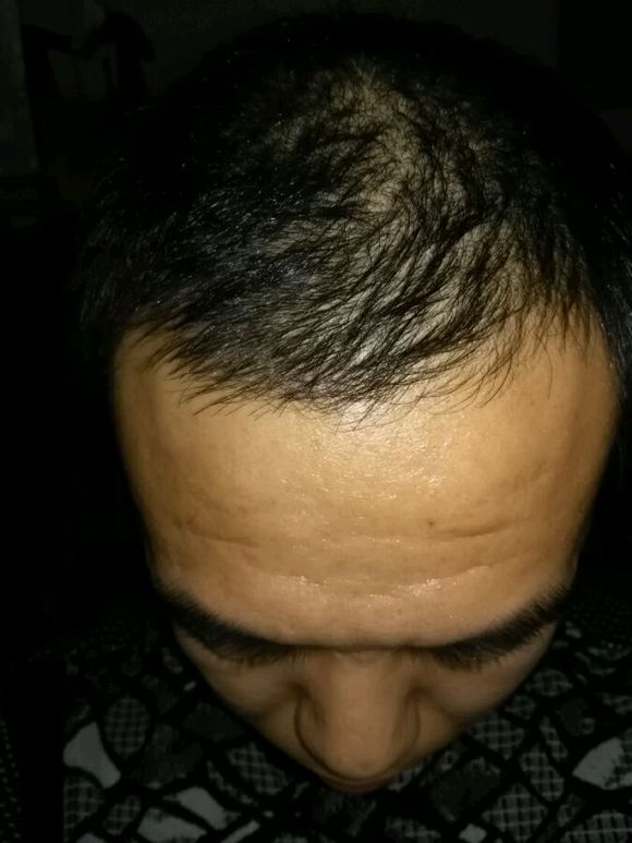 ”【忏悔过错】脱发问题＋戒色感悟