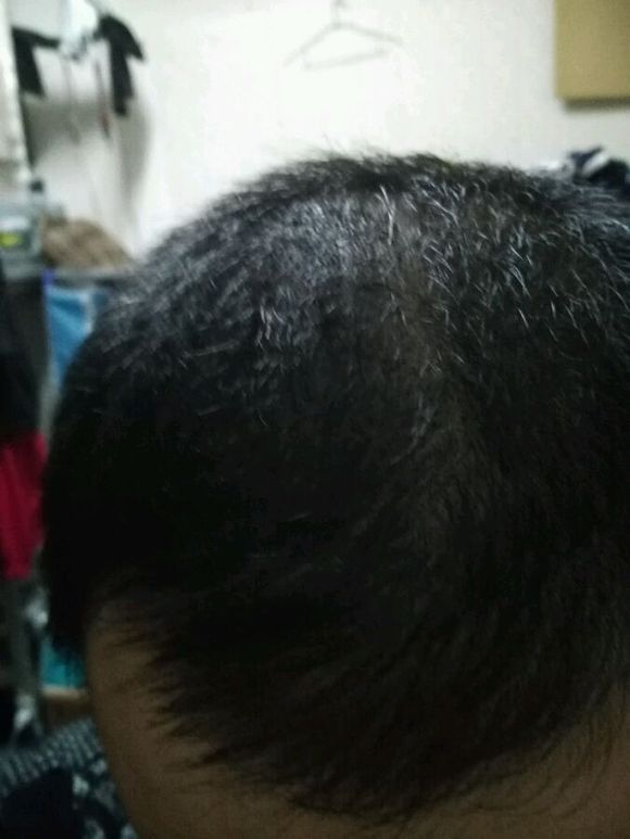 ”【忏悔过错】脱发问题＋戒色感悟