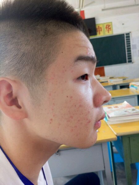 ”【成长记录】记录脸部气色等改善