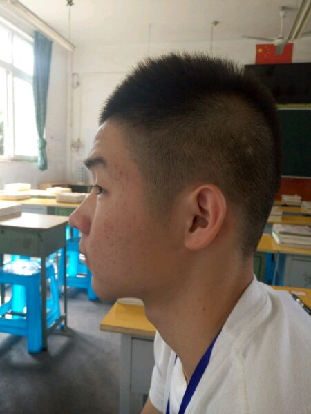 ”【成长记录】记录脸部气色等改善