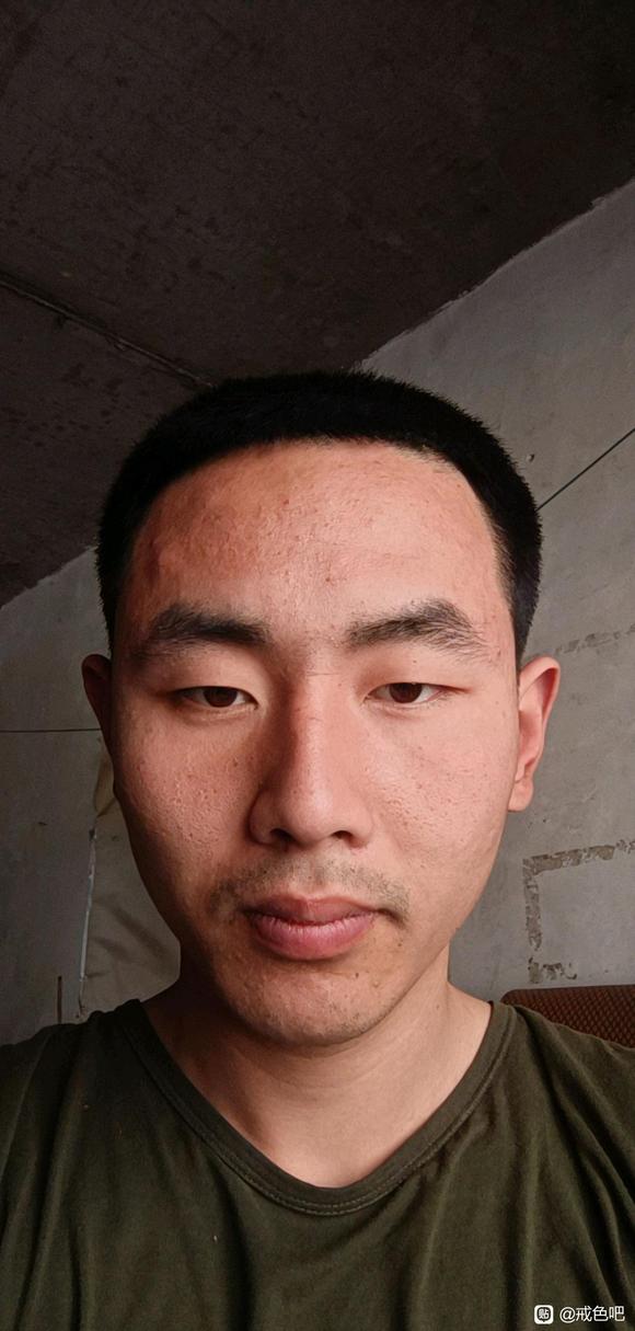 ”大家看看我面色恢复的怎么样了