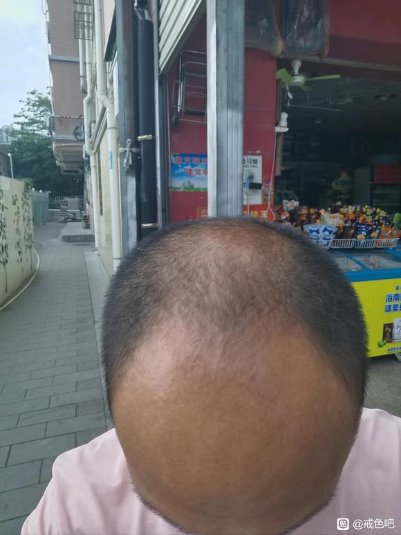 ”最近看着头发又emo了，请告诉我头发怎么恢复