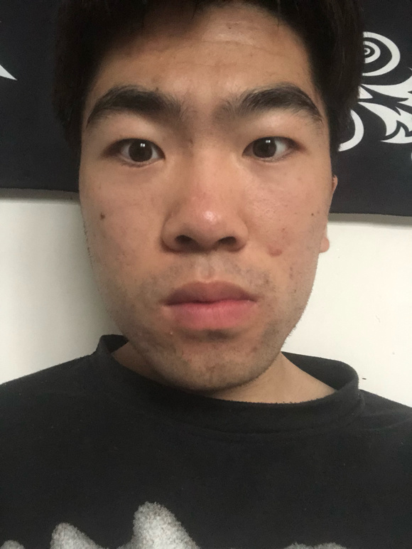 ”sy9年现在脑子懵懵