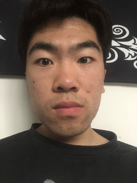 ”sy9年现在脑子懵懵