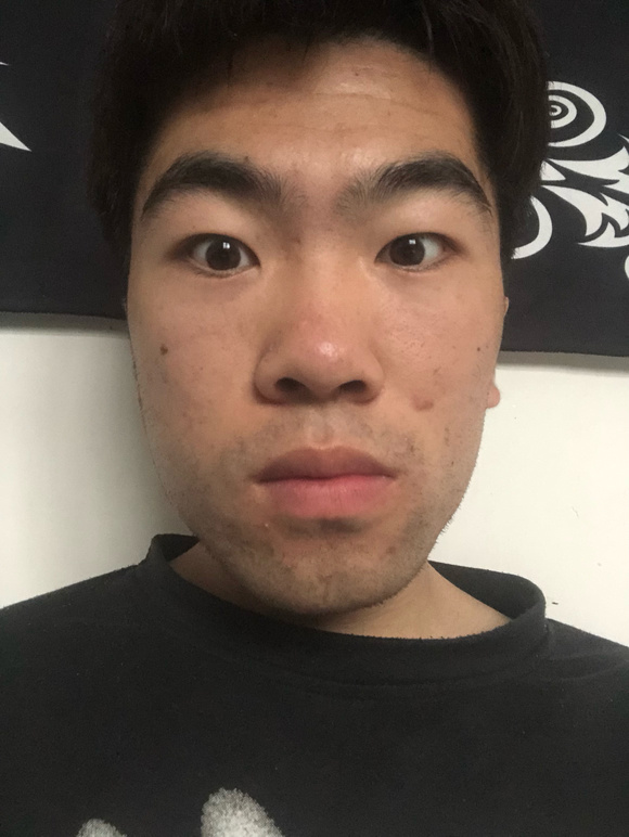 ”sy9年现在脑子懵懵