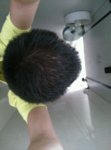 ”【成长记录】戒色之头发恢复篇